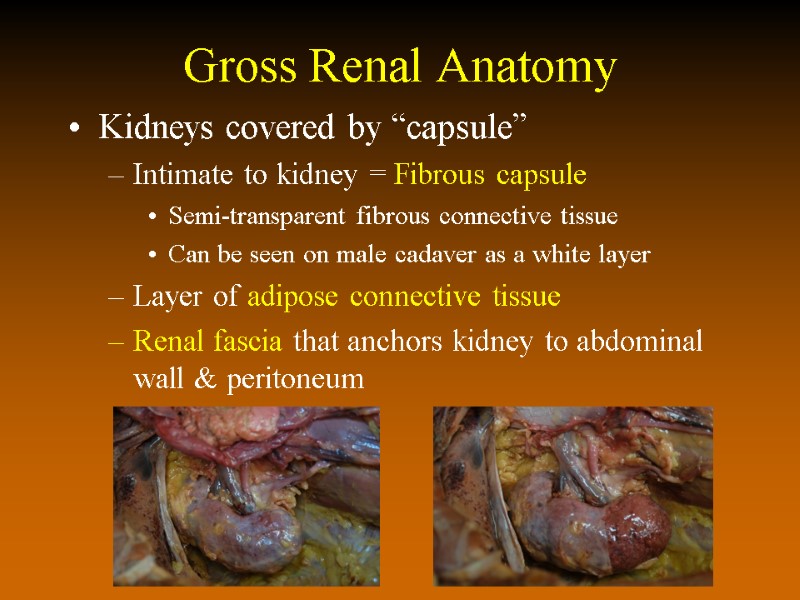 Gross Renal Anatomy Kidneys covered by “capsule” Intimate to kidney = Fibrous capsule Semi-transparent